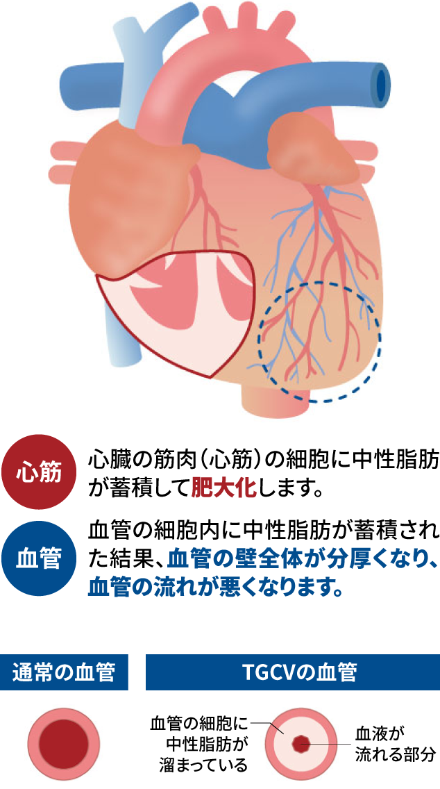 心筋…心臓の筋肉（心筋）の細胞に中性脂肪が蓄積して肥大化します。血管…血管の細胞内に中性脂肪が蓄積された結果、血管の壁全体が分厚くなり、血管の流れが悪くなります。通常の血管とTGCVの血管の比較：TGCVの血管は血管の細胞に中性脂肪が溜まっており、血液が流れる部分が狭くなっている